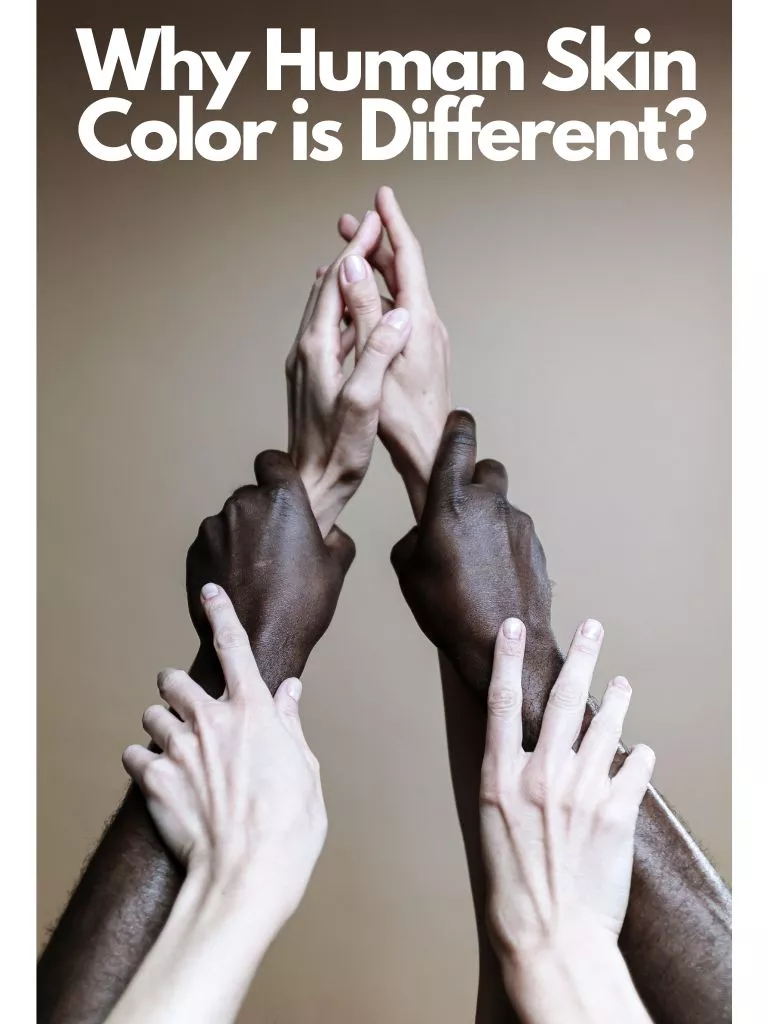 Why Human Skin Color is Different